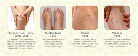 Sorgen Class II Medical Compression Stockings for Varicose Veins ...