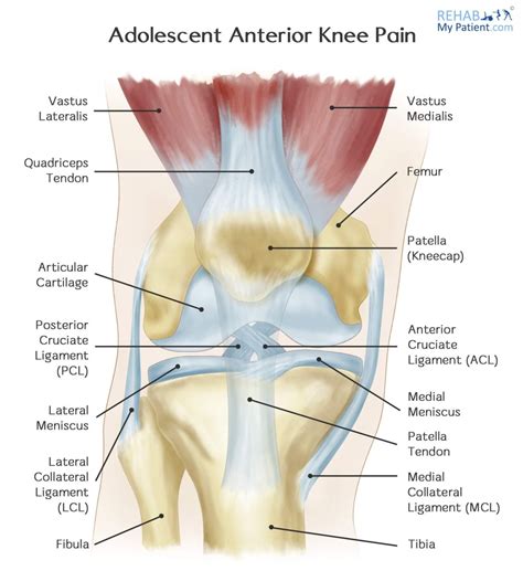 Adolescent Anterior Knee Pain | Rehab My Patient