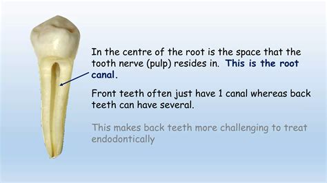 Why is a rct needed? | PPT