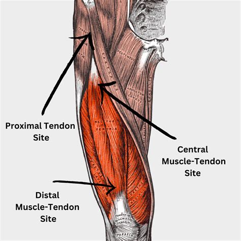 Quadriceps Femoris Tendon