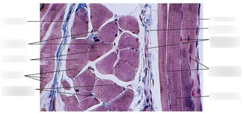 Skeletal Muscle Tissue Histology 2 Diagram | Quizlet