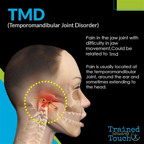 Tooth Nerve And Tmj Pain