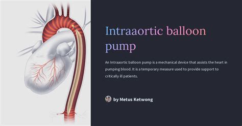 Intraaortic balloon pump