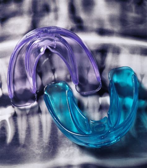 Clear aligner treatment