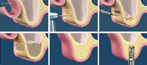 Image result for Postambule Olympe De Gouges Lecture Linéaire