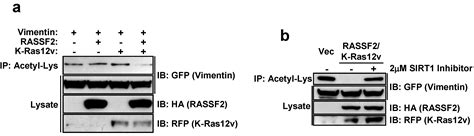 Proteomics Analysis Reveals Novel RASSF2 Interaction Partners
