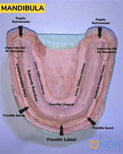 Anatomia de la mandíbula sin dientes (Modelo Inferior en yeso ...