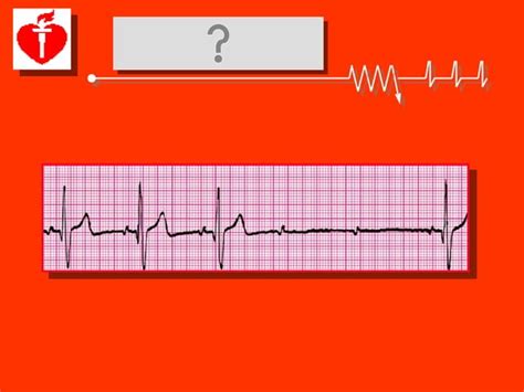 Image result for ACLS Mega Code