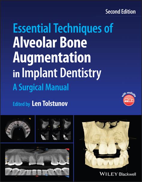 Essential Techniques of Alveolar Bone Augmentation India | Ubuy