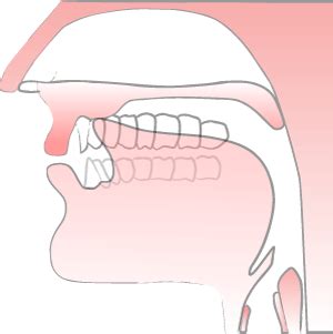 Sound of T 的图像结果