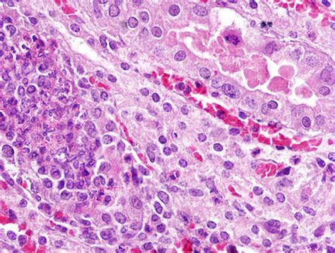 IVRIPalampur:Indian Veterinary Research Institute