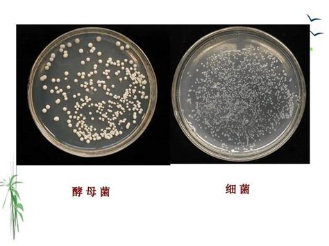 真菌的形态结构与繁殖体_菌丝_孢子_细胞