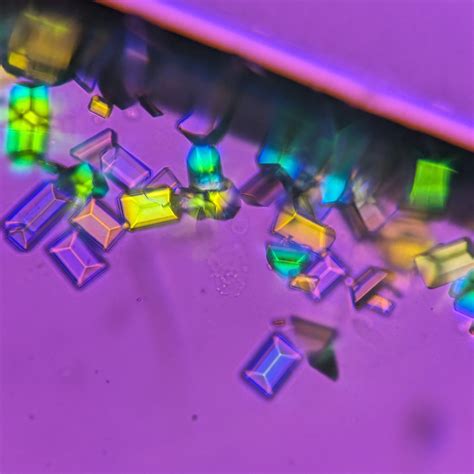 Triple Phosphate Crystals: Identification & Clinical Significance