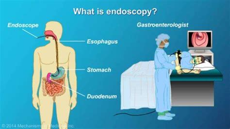 The Role of Endoscopy in Sleeve Gastrectomy Surgery