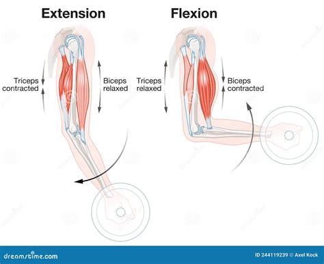 Flexion Vs Extension Arm at Wallace Yang blog