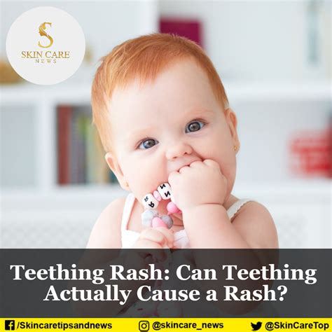 Cream For Teething Rash On Face at Johanna Engles blog