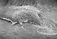 Image result for osteoclast 破骨细胞