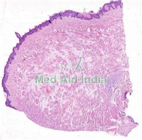 Oral Histology Slide Fungiform Papillae Tongue Manufacturer, Supplier ...