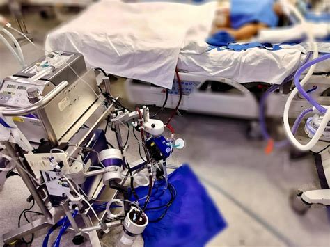 11-year-old girl saved by ECPR after cardiac arrest: Know about this ...