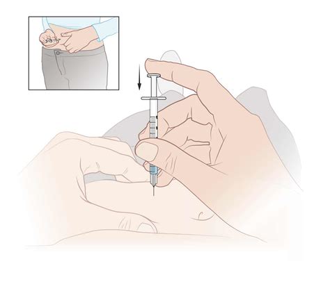 Image result for SubQ Injection Technique