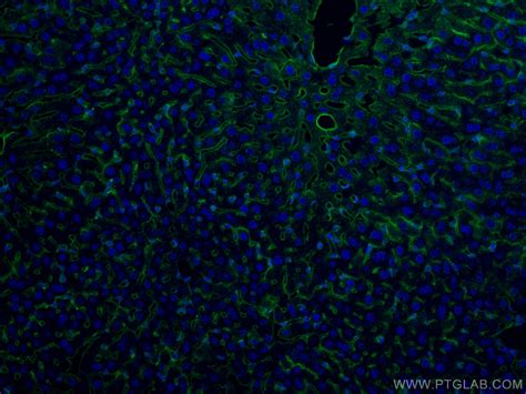 ICAM-1/CD54 antibody (10020-1-AP) | Proteintech