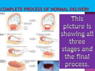 Image result for Delivery Procedure