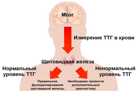 Гипотериоз щитовидки. Почему так часто встречается.