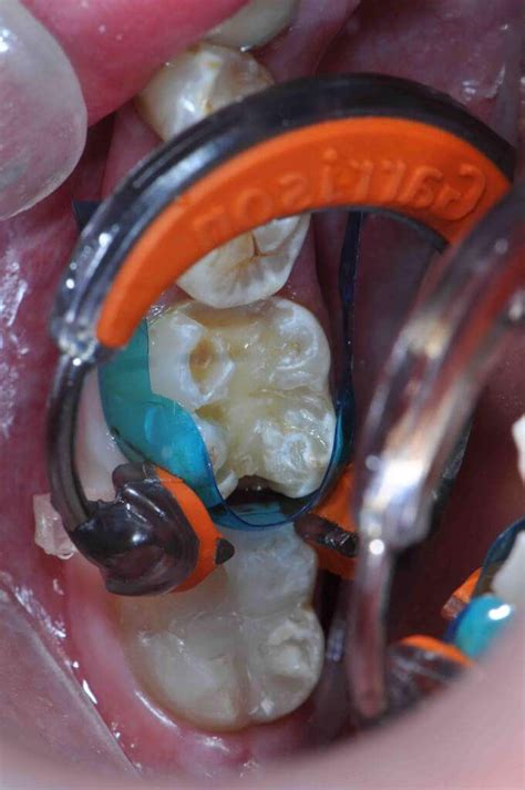 Image result for Sectional Matrix