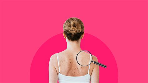 What does a dermatologist do? Read before your next appointment