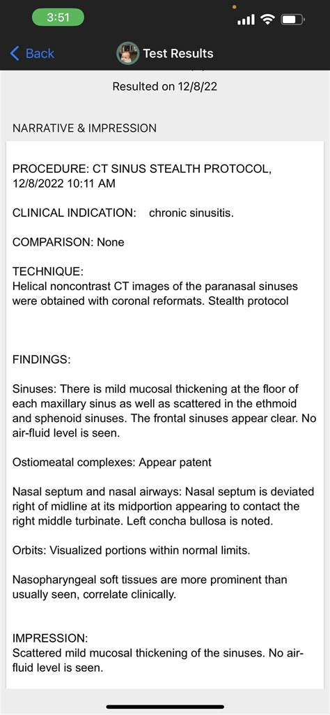 Enlarged turbinates and thick mucus : r/Sinusitis