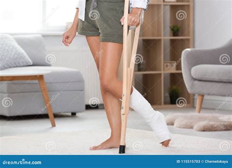 Young Woman with Crutch and Broken Leg in Cast at Home Stock Image ...