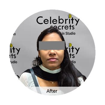 Customized skin whitening - Celebrity Secrets
