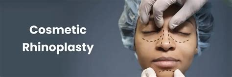 Achieve Facial Balance with Cosmetic Rhinoplasty