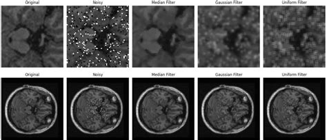 Image result for Python for MRI Data Processing