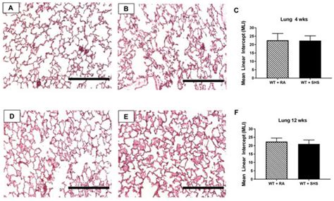 Antenatal Secondhand Smoke (SHS) Exposure and the Receptor for Advanced ...