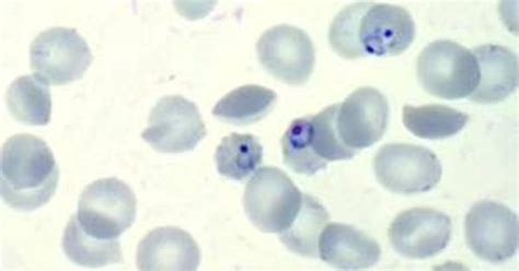 Lab notes: A new malaria vaccine that could confer full immunity ...