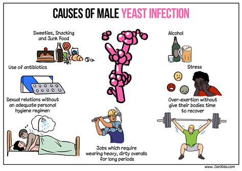 Main Causes Of Male Yeast Infections | Yeast infection men, Yeast infection, Candida yeast