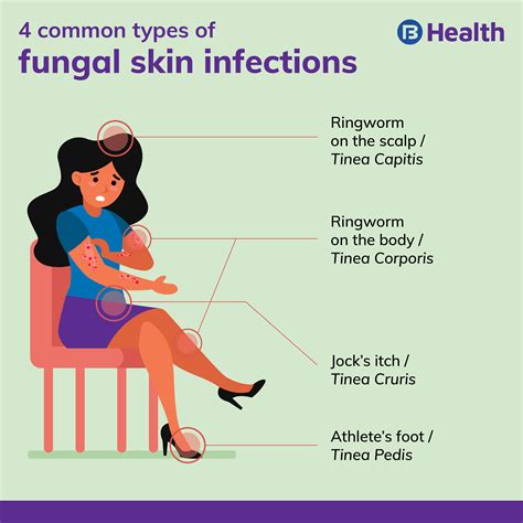 Home remedies to fight fungal skin infections