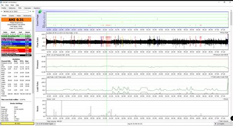 Image result for CPAP FiO2