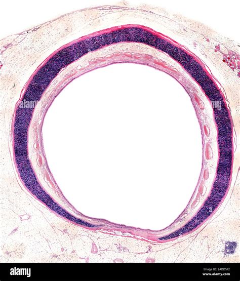Light micrograph of a cross-section of the trachea, showing C-shaped ...
