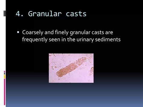 Microscopic examination of urinary sediments | PPTX