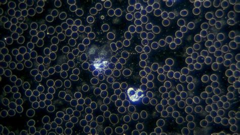 Dark Field Microscope HD-Set | SARRAS e.U.