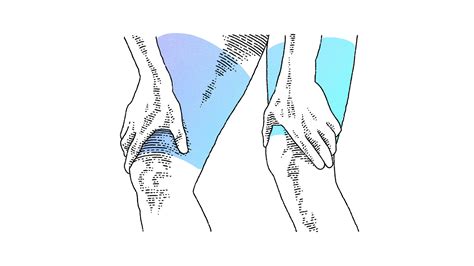 Testosterone Gel Application at Spencer Burley blog