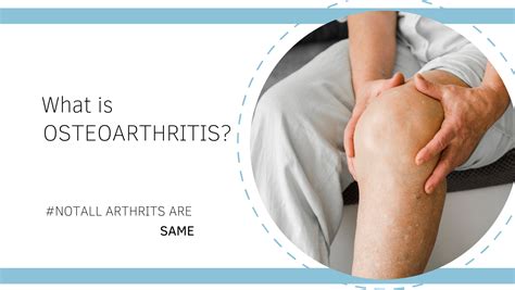 Osteoarthritis: Causes, Symptoms, Risk Factors, and Supplements that C ...