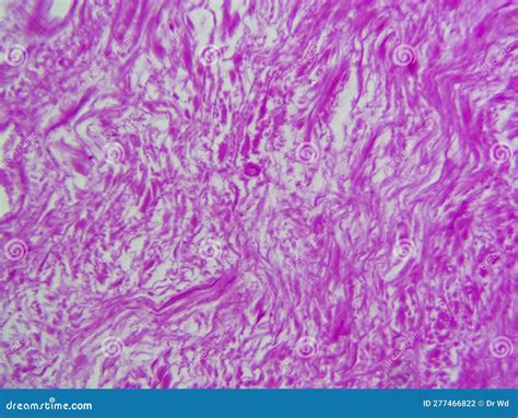 Dense Connective Tissue,rattit Under The Microscope Royalty-Free Stock ...