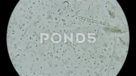 Mold Under Microscope 的图像结果