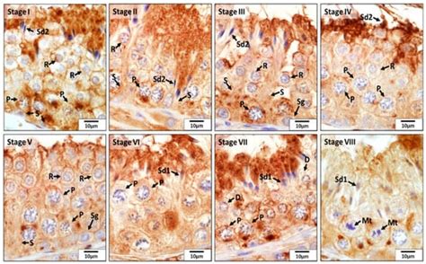 Testicular Expression of Antioxidant Enzymes and Changes in Response to ...