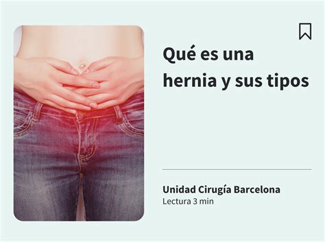 Qué es una hernia y sus tipos – Unidad Cirugia Barcelona