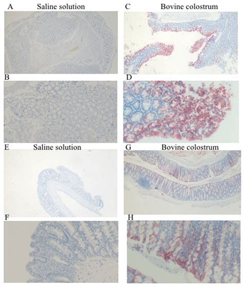 Antioxidant Activity of Bovine Colostrum in the Colon of a Mouse Model ...