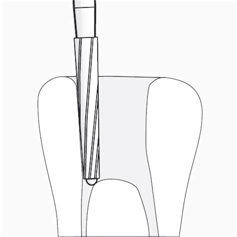 Buy SuperEndo Endo-Z Tungsten Carbide Burs – Oralkart